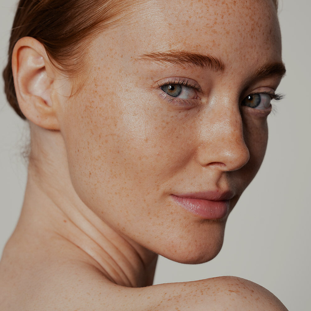 Picture of a young woman with freckles.